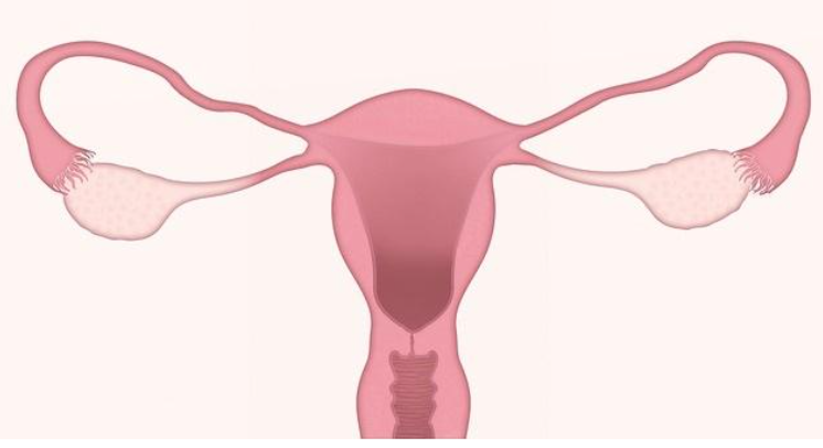 Remedii naturale pentru chisturi ovariene și fibrom uterin! Tratamente și plante naturiste
